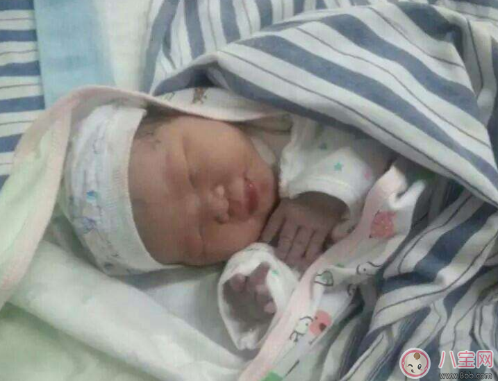 孕幾周的時候進行剖腹產手術比較好 剖腹產什么時候最疼