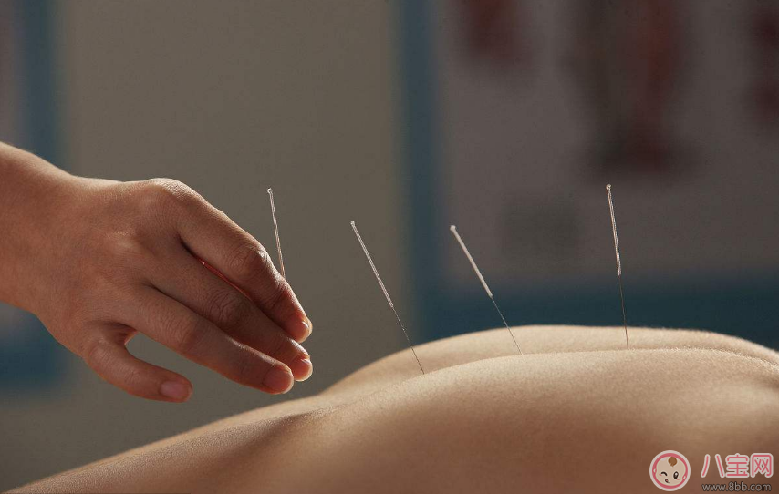 懷孕初期能做針灸嗎 懷孕做針灸會怎么樣