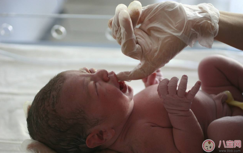 開十指真的有十個指頭那么大嗎 宮口開十指有多大 開十指真的有十個指頭那么大嗎 宮口開十指有多大