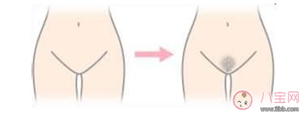 女性私密處變黑是什么原因 女性私密處保養方法