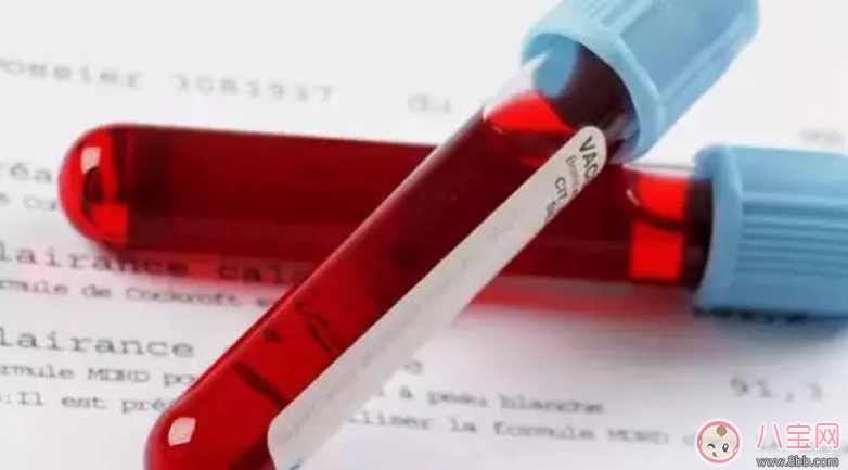 奶粉蛋白質過敏和母乳蛋白過敏怎么辦  蛋白質過敏吃什么奶粉