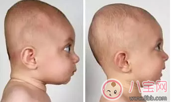 2歲以內的寶寶需要枕枕頭嗎  別讓那些老觀念帶偏了