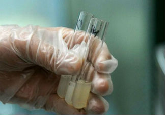 弱精癥的癥狀有哪些 弱精癥的治療方法