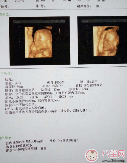 系統彩超和四維的區別 普通彩超和四維哪個要好一些