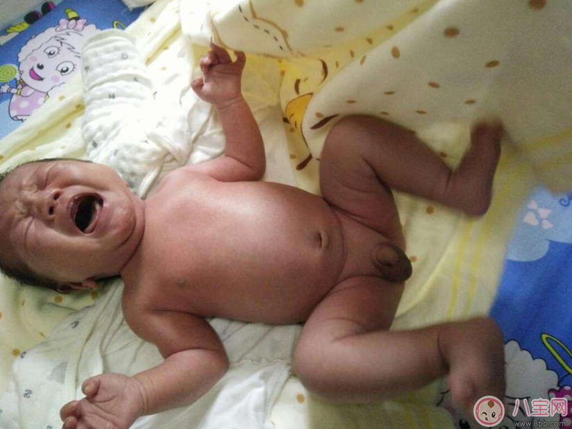 預產期到了沒生怎么辦 預產期到了沒生需要催產嗎 預產期到了沒生怎么辦 預產期到了沒生需要催產嗎