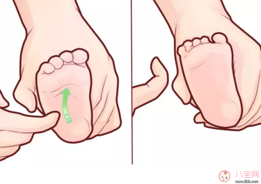 新生兒巴賓斯基反射怎么時候消失 賓斯基反射陽性陰性