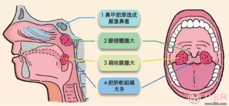 孩子睡覺張嘴打呼嚕怎么回事  寶寶睡覺張嘴打呼嚕怎么辦