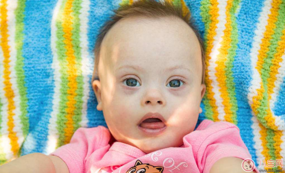 唐氏篩查多少錢2018 唐氏篩查具體金額