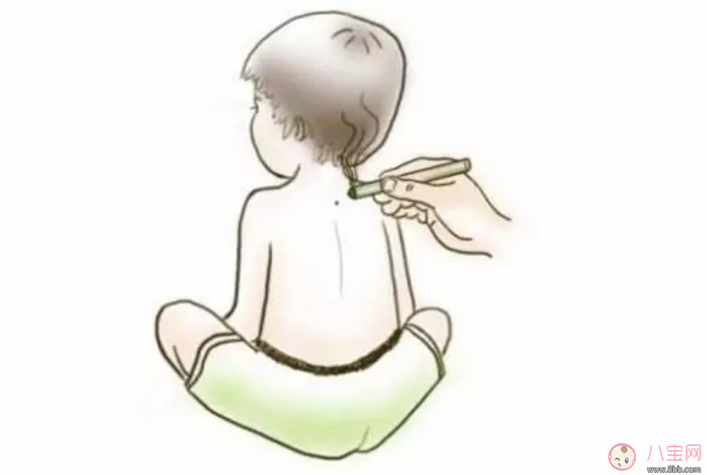 如何用艾灸提高寶寶免疫力 艾灸哪些穴位能增強小兒抵抗力