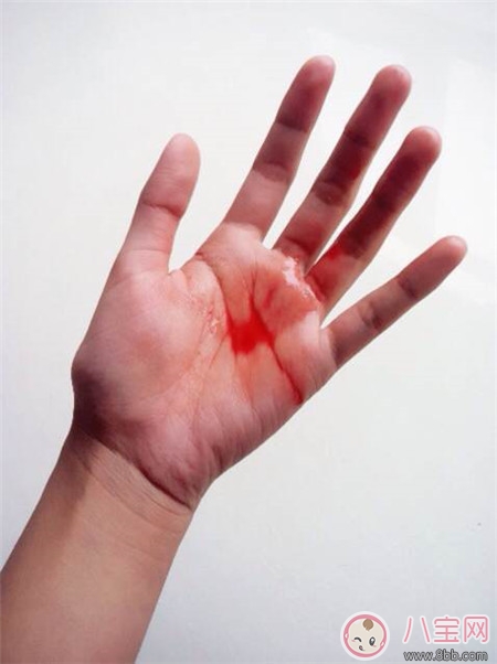 上環出血幾天算正常 上環后出血怎么辦