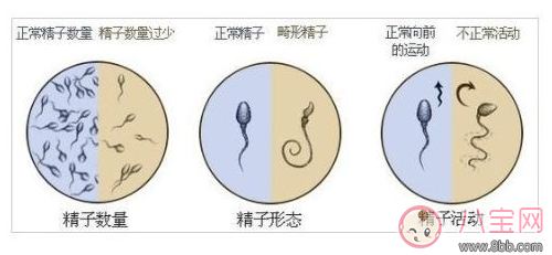 精子的正常標準有哪些 精子異常有哪些形態