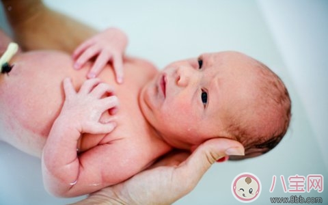 小兒疝氣怎么治療 小兒疝氣有什么癥狀