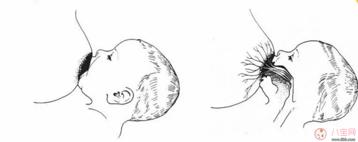 母乳喂養乳頭變白發硬怎么回事 乳頭變白且硬怎么辦