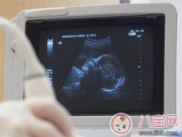 懷孕最早什么時候能測出結果 懷孕什么時候有癥狀表現