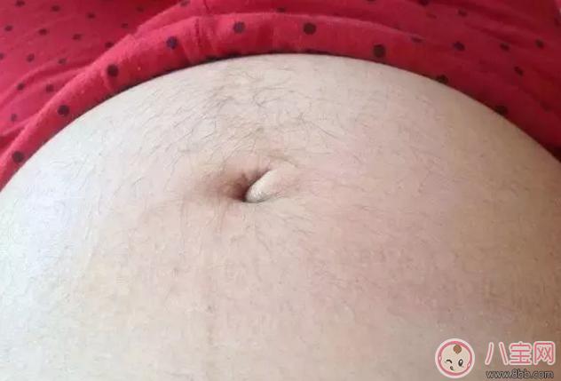 懷孕兩個月肚子長絨毛怎么回事 生完孩子肚子上的毛會消失嗎 懷孕兩個月肚子長絨毛怎么回事 生完孩子肚子上的毛會消失嗎