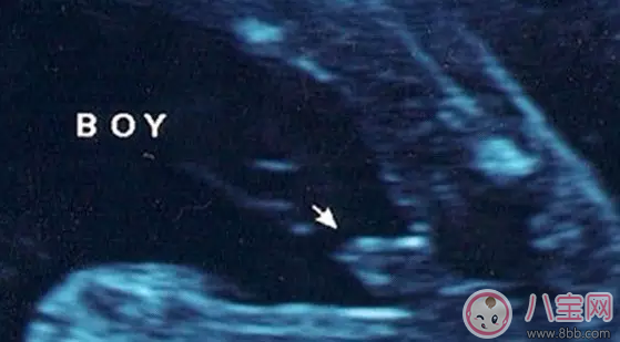 杜若溪懷的是男是女 嚴(yán)屹寬的寶寶是男孩嗎