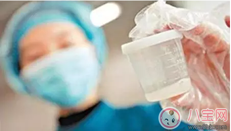 男人身體好就不用去做精子檢查嗎 做精子檢查操作方法2018 男人身體好就不用去做精子檢查嗎 做精子檢查操作方法2018