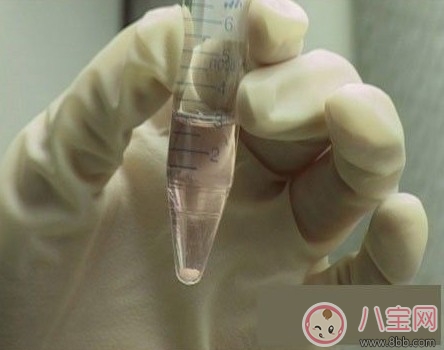 怎樣提高人工授精成功率 人工授精要花多少錢