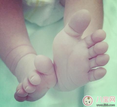 剖腹產會不會造成孩子肥胖 分娩方法孕婦要怎樣選擇 剖腹產會不會造成孩子肥胖 分娩方法孕婦要怎樣選擇