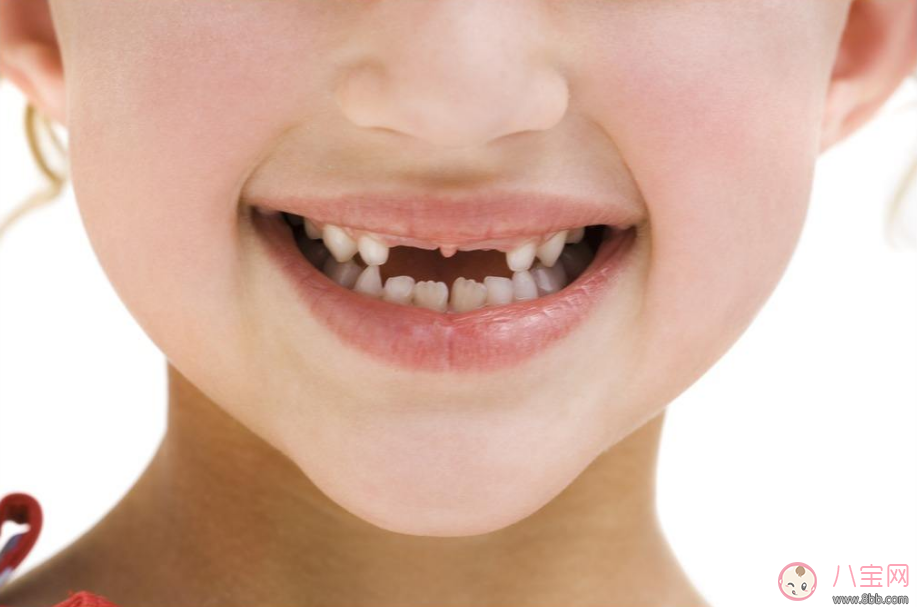 孩子換牙說話結巴怎么辦 孩子換牙齒的時候不自信怎么安撫