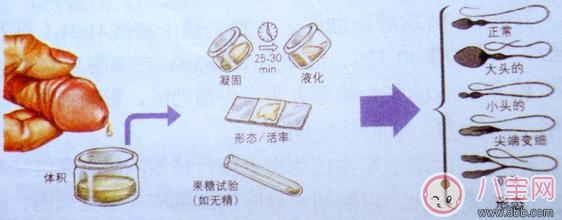 精液不液化是怎么回事 精液不液化治療起來容易嗎