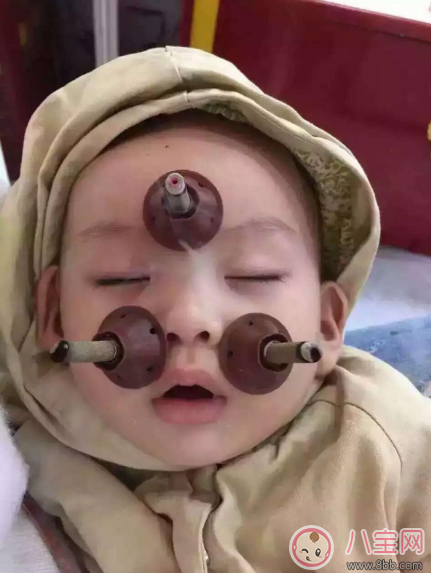 孩子可以用艾灸嗎 小孩艾灸需要多長時間