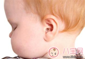 孩子老喊耳朵疼是中耳炎嗎 為什么孩子容易感染中耳炎