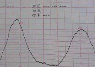 胎監評分怎么看 2018胎監評分多少分算正常