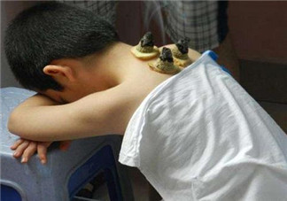 孩子發(fā)燒可以艾灸嗎 小孩發(fā)燒艾灸好不好