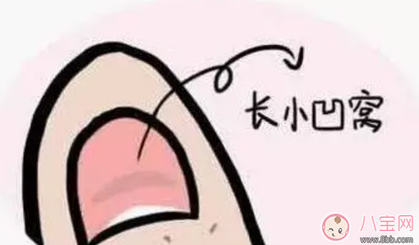 小孩指甲有一個凹陷的小窩怎么辦 寶寶手指蓋上長小凹窩是什么原因 小孩指甲有一個凹陷的小窩怎么辦 寶寶手指蓋上長小凹窩是什么原因