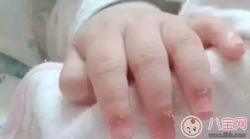 寶寶指甲粗糙是缺什么維生素 寶寶指甲粗糙吃哪些食物好