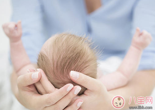 寶寶眼屎多又黃怎么回事 寶寶眼屎多又黃怎么辦