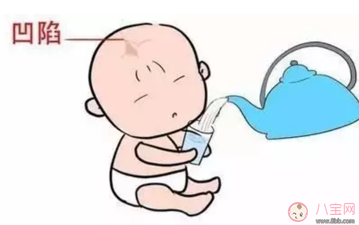 囟門閉合早晚和寶寶智力有關系嗎 寶寶囟門和智商有關系嗎