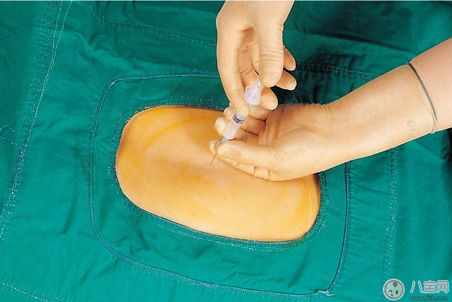 無(wú)痛分娩會(huì)對(duì)孩子產(chǎn)生什么樣的影響 無(wú)痛分娩好不好