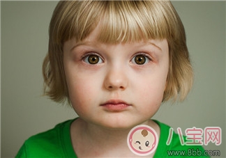 幼兒有黑眼圈怎么回事 小孩有黑眼圈是睡眠不足嗎