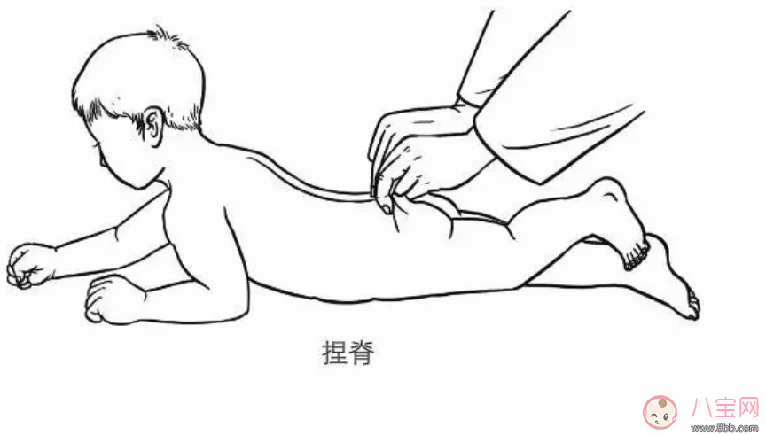 小兒捏脊推拿的正確手法是什么 哪些孩子不適宜捏脊推拿治療