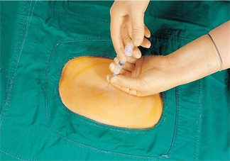 無痛分娩會對孩子產(chǎn)生什么樣的影響 無痛分娩好不好