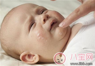 小孩濕疹反復(fù)怎么辦 濕疹為什么會(huì)反復(fù)發(fā)作