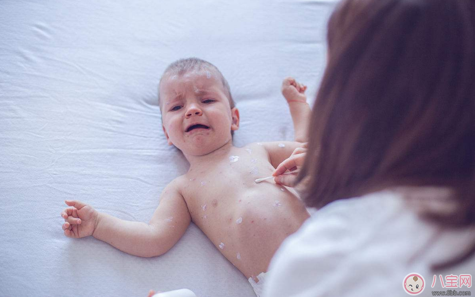 春季孩子過敏有哪些癥狀 孩子過敏預(yù)防方法