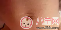 寶寶肚臍出現(xiàn)哪些狀況要護(hù)理 孩子肚臍異常注意事項(xiàng)