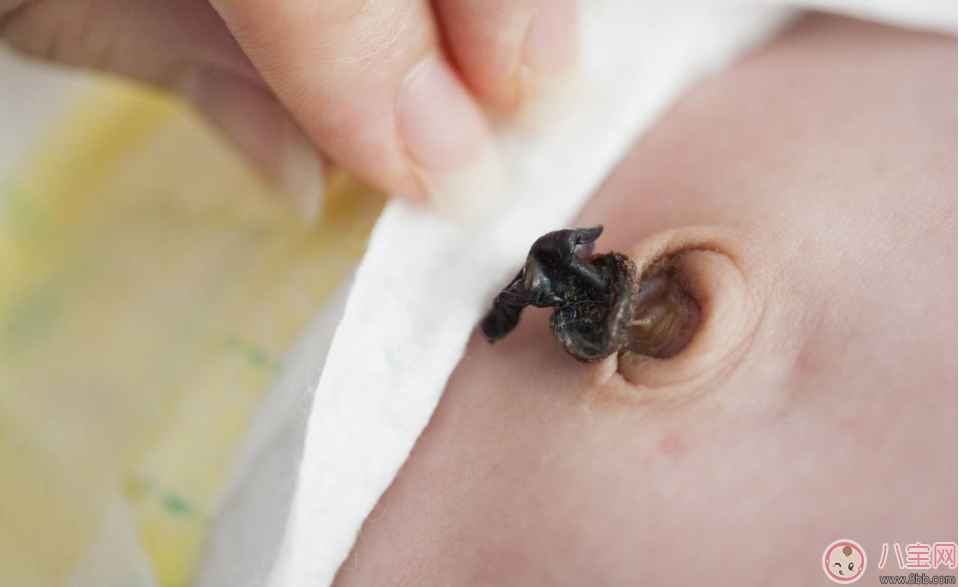 新生兒的臍帶要多久才脫落 寶寶臍帶脫落后如何護理