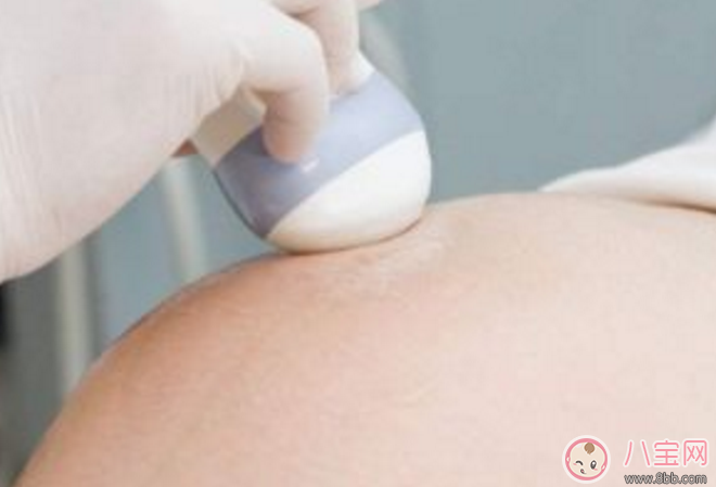 孕早期可以做陰道B超嗎 孕早期陰道B超有沒有必要做呢