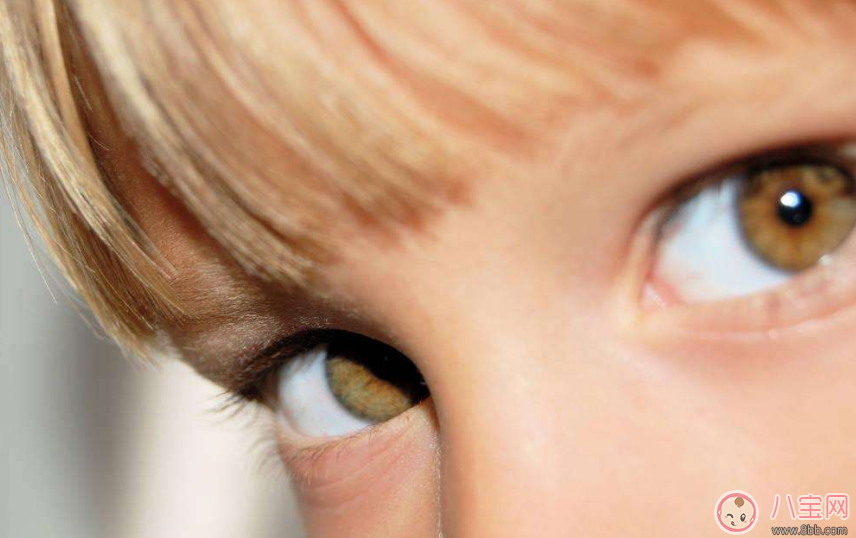 寶寶有眼垢是因為熱氣上火嗎 孩子眼屎多是什么原因