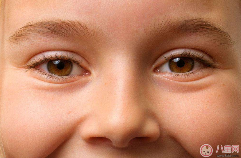 寶寶有眼垢是因為熱氣上火嗎 孩子眼屎多是什么原因