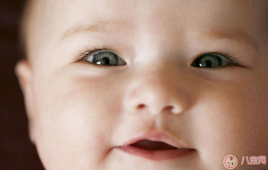 寶寶有眼垢是因為熱氣上火嗎 孩子眼屎多是什么原因