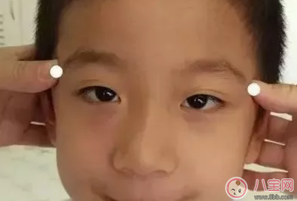 小兒流鼻涕推拿方法 寶寶流鼻涕怎么推拿按摩