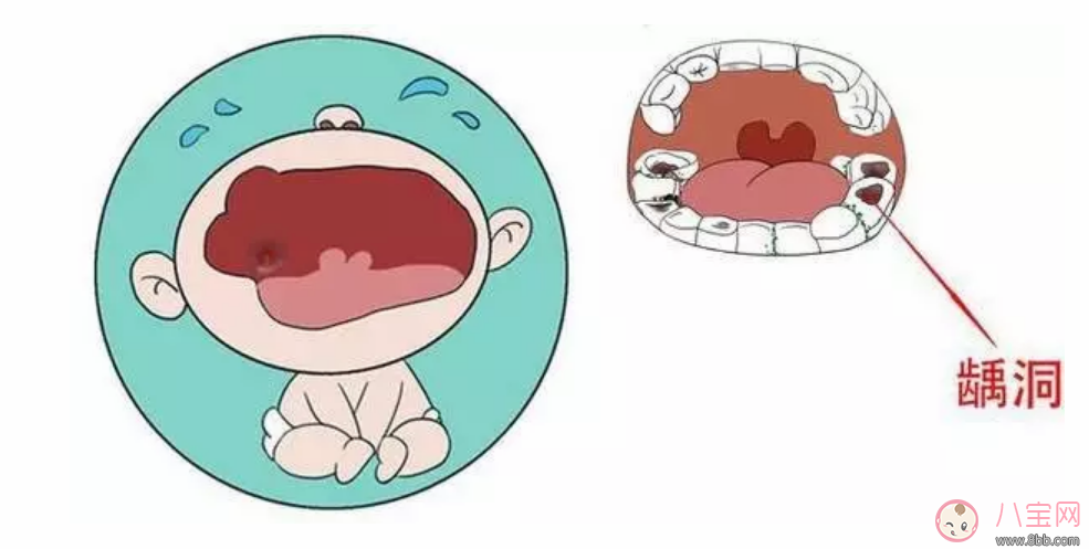 寶寶愛上吃糖怎么辦 怎樣改掉寶寶愛吃糖的壞習慣