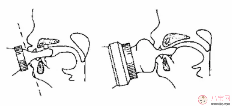 1歲寶寶為什么牙齒不整齊 寶寶牙齒不齊要矯正嗎 1歲寶寶為什么牙齒不整齊 寶寶牙齒不齊要矯正嗎