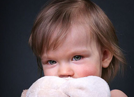 皮膚過敏不能吃什么 皮膚過敏可以吃雞蛋嗎 皮膚過敏不能吃什么 皮膚過敏可以吃雞蛋嗎