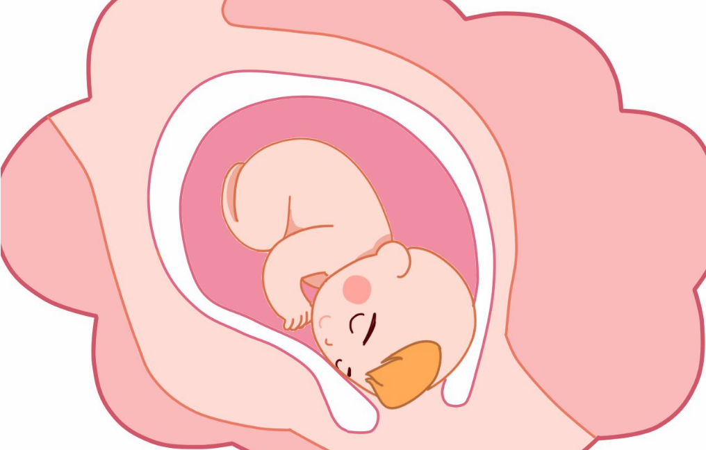 什么原因?qū)е碌脱蛩?如何預(yù)防羊水過少